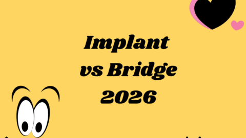Implant vs Bridge
